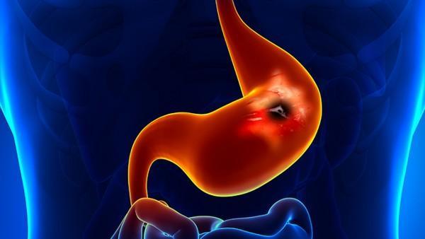 镰状细胞病忌口食物有哪些