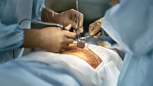 周期性月经大出血的治愈率有多高