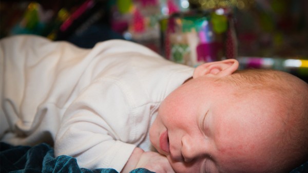 红斑痤疮的治愈率有多高