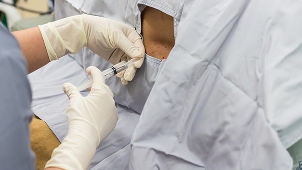 多发性骨髓瘤可以预防吗