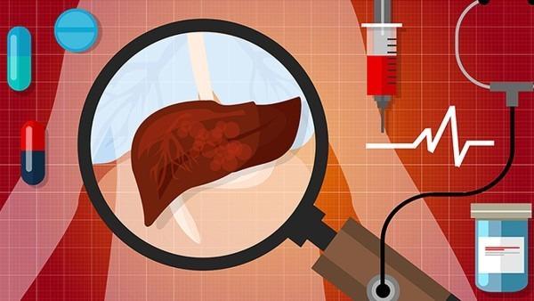 子宫癌患者该如何锻炼身体