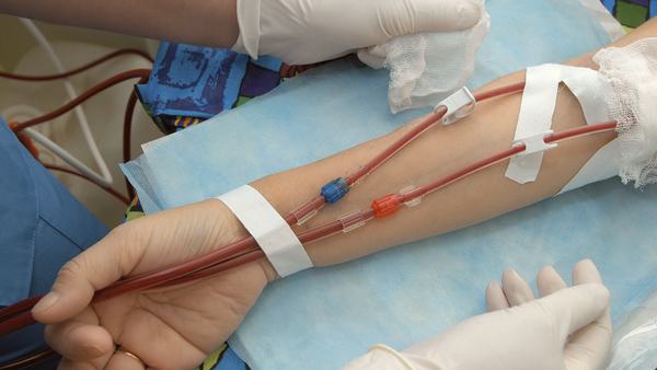 高眼压症的护理措施有哪些