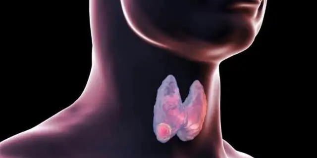 结节并非肿瘤，应该如何处理？