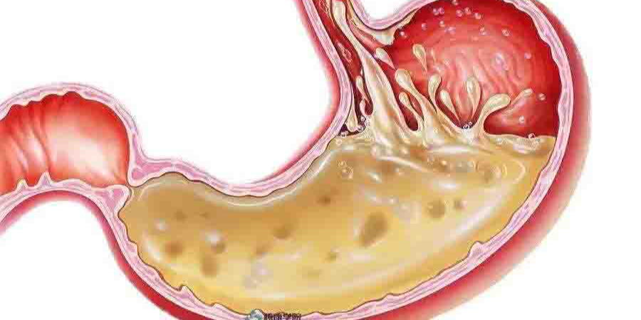 消化性溃疡治疗现状展望，专家呼吁重视消化系统健康