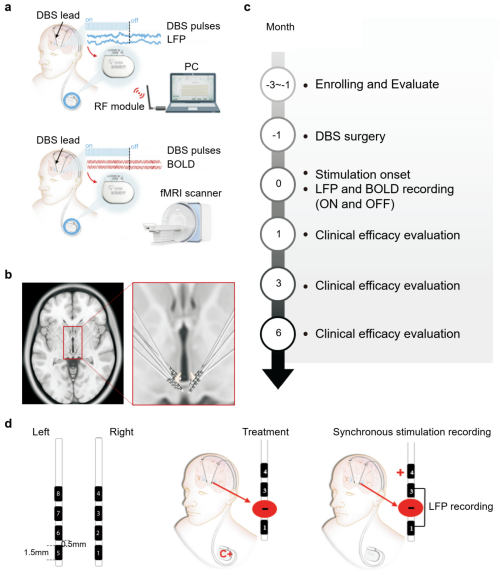 1721375126721735.png zx20240719095023905966624733.png