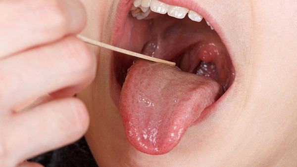 激光能治疗白癜风吗