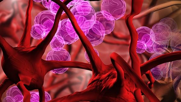 瑜伽和运动对老年女性尿失禁的治疗潜力