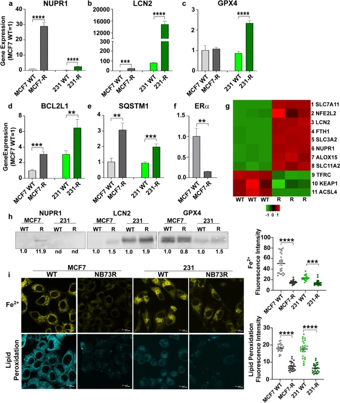 FOXM1抑制剂耐药性机制的研究：通过铁死亡通路逆转癌细胞抗性的新策略