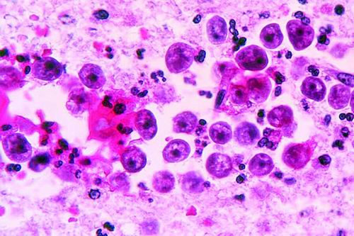 警惕“食脑虫”感染：致命的自由生活阿米巴原虫