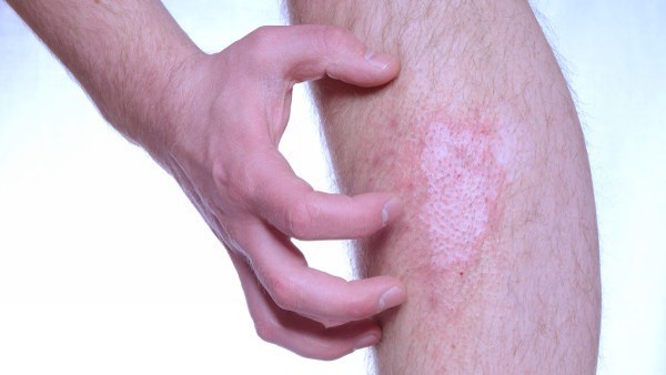 先兆流产的孕妇安胎方法