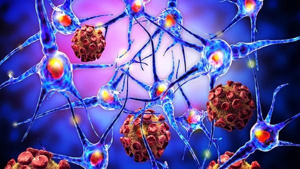 黑色素瘤患者的保持清洁卫生