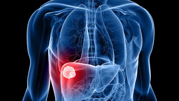 麻风的治疗费用大概是多少？