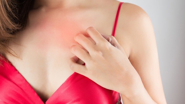 登革热发烧后会出汗吗