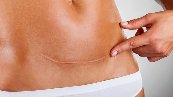 鼻窦炎患者可以锻炼吗