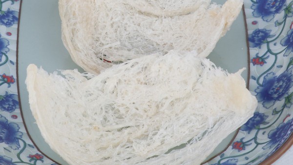 低血糖症的尿液检查结果