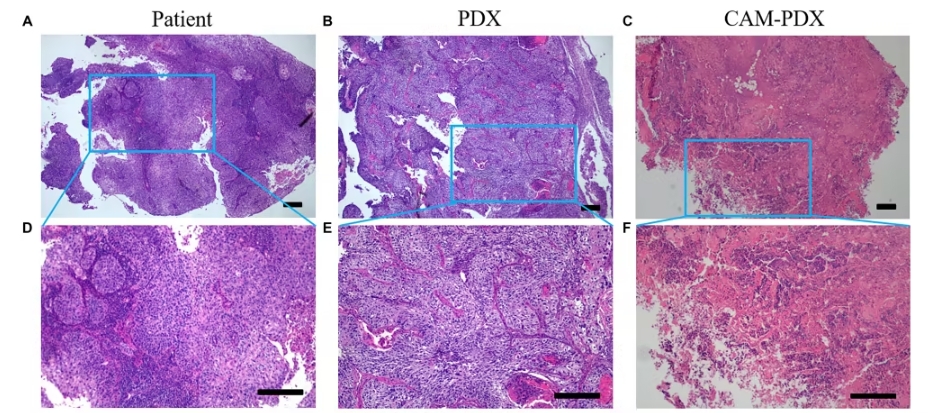穿心莲内酯或成宫颈癌治疗新希望：最新研究揭示其抑瘤机制