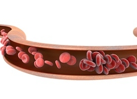 癌症相关VTE患者：低剂量阿哌沙班疗效不逊全剂量，同时显著减少出血风险