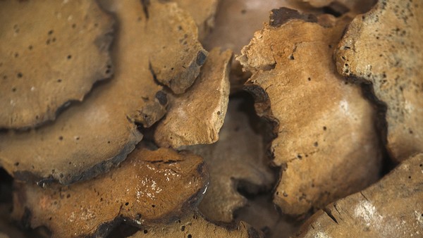 苔藓样念珠状疹的医学检查与诊断