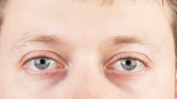 高胰岛素性低血糖症患者的休息与睡眠