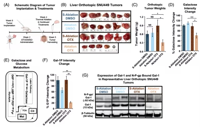 “烧不死的癌细胞”如何卷土重来？新研究揭开Gal-1助攻的秘密