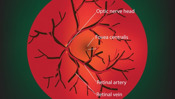 念珠菌性甲沟炎的化验检查项目