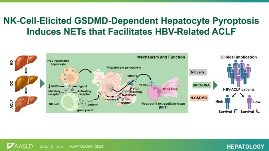 研究揭示乙肝相关慢加急性肝衰竭（ACLF）进展新机制