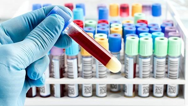 低钠血症的电解质检查指标