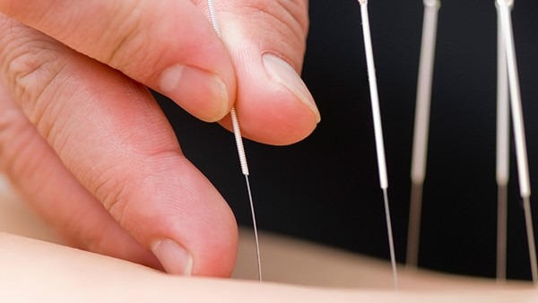 甲状腺炎与饮食有关系吗