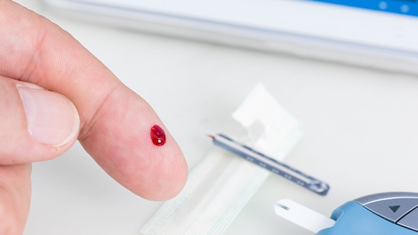 类风湿关节炎的临床诊断