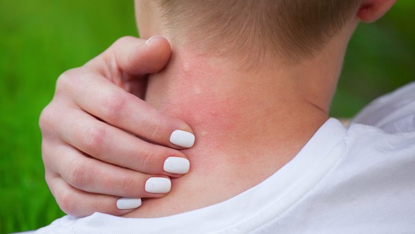 风热感冒可以吃辣椒吗