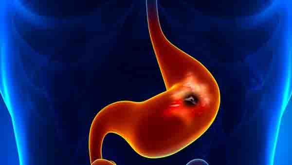 中耳炎需要服用抗病毒药物吗