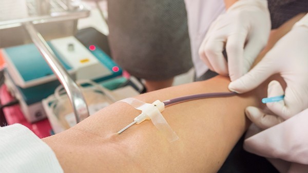 毛囊炎的恢复期间注意什么