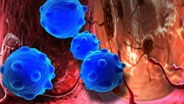 中风后的心理疏导