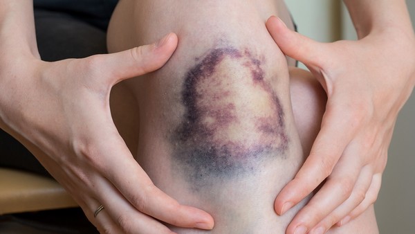 肢端肥大症的运动疗法