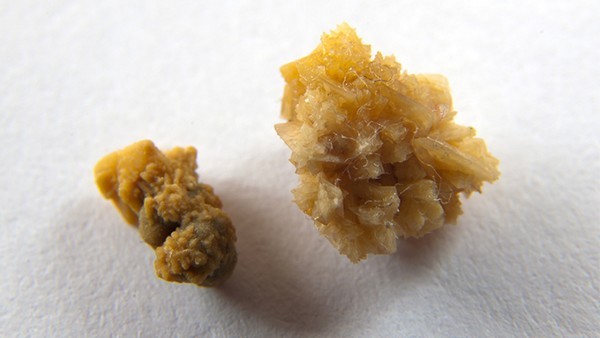 黄水疮的药物副作用