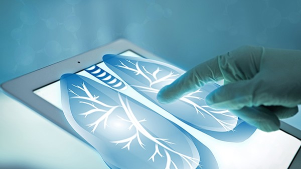 神经纤维瘤是否与其他疾病相关